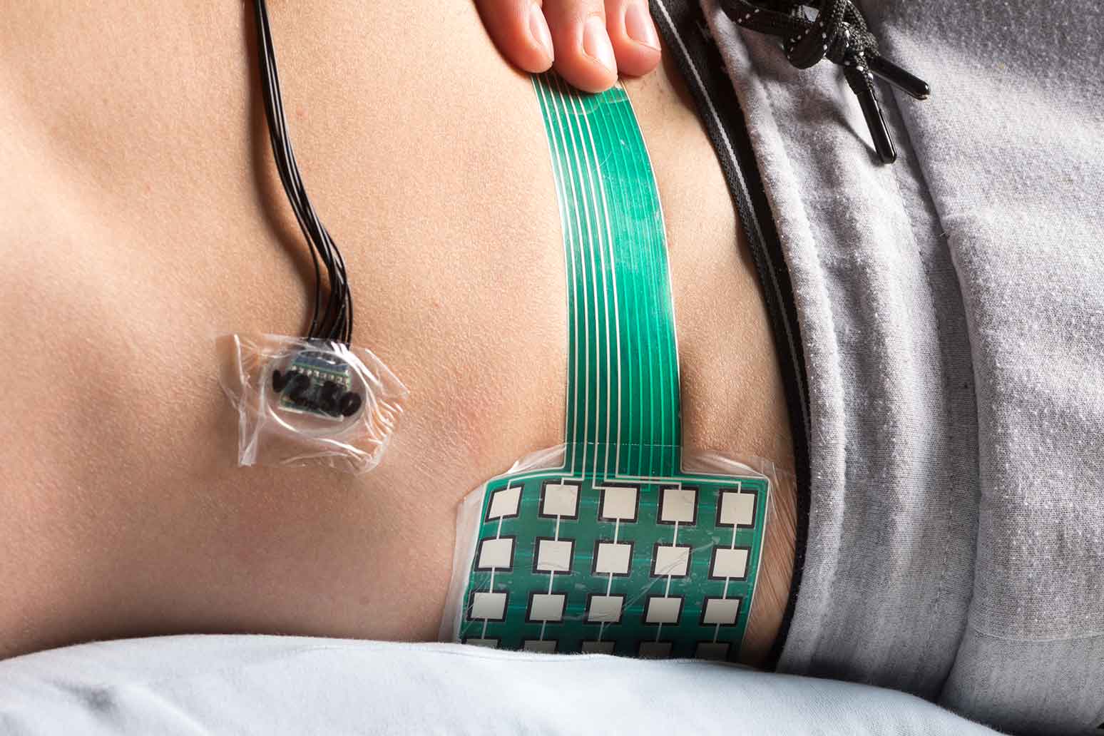 Sensor system for pressure ulcer prophylaxis