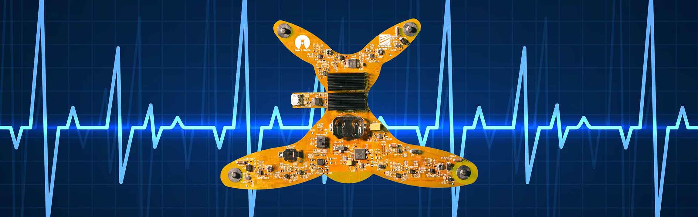 Energy-autonomous Sensor System for Cardiac Monitoring